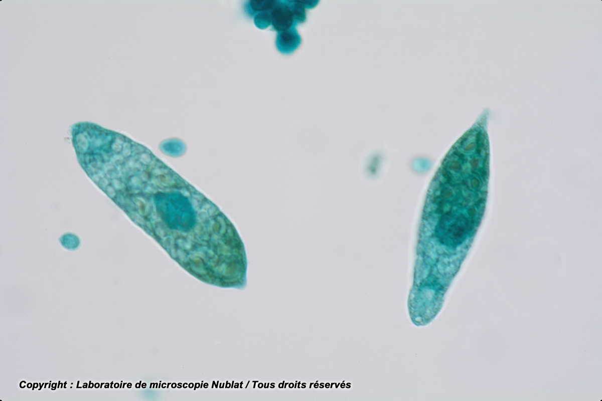 Phytoflagellés : Euglènes, VL